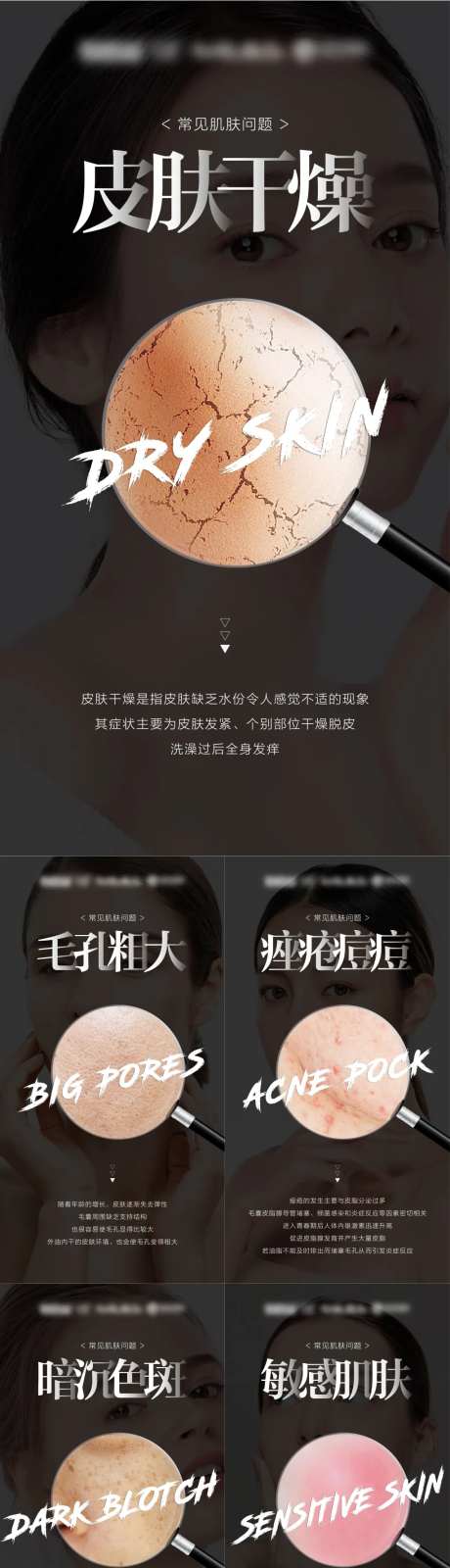 常见肌肤问题大字报系列海报-采灵感-https://www.cailinggan.com/