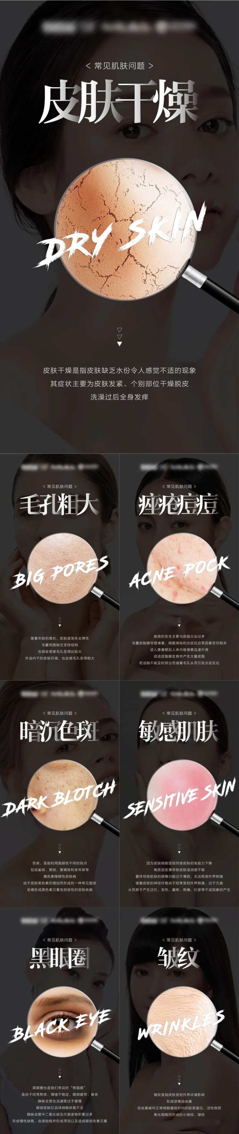 常见肌肤问题大字报系列海报-采灵感-cailinggan.com