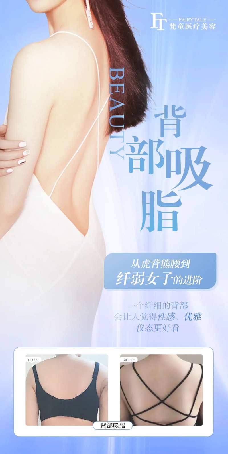 背部吸脂-采灵感-cailinggan.com