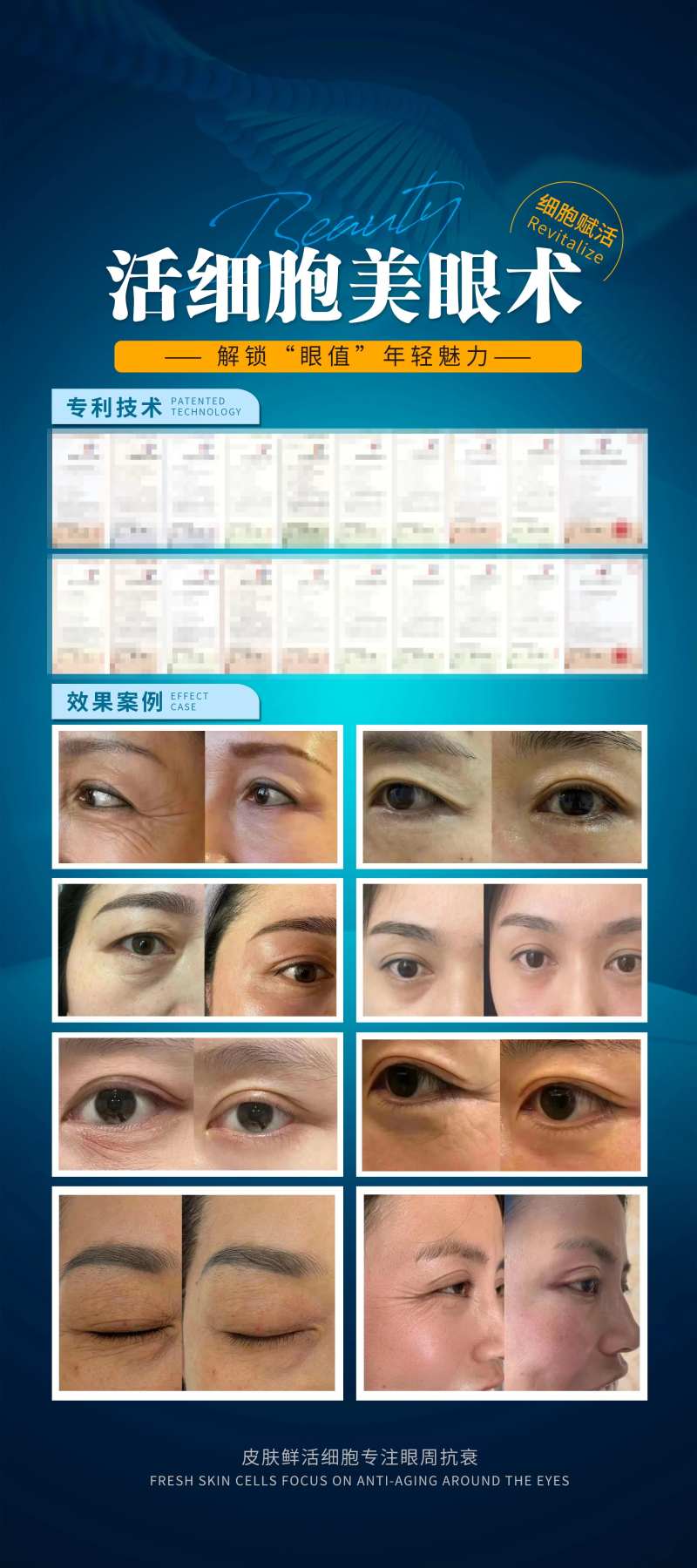 美眼术展架-采灵感-cailinggan.com