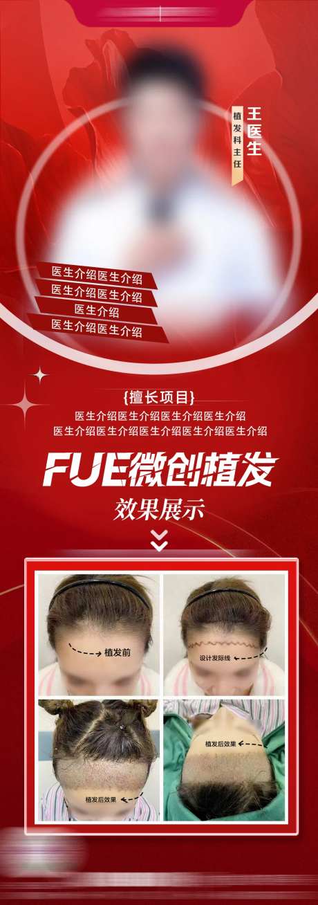 fue植发医生海报-采灵感-https://www.cailinggan.com/