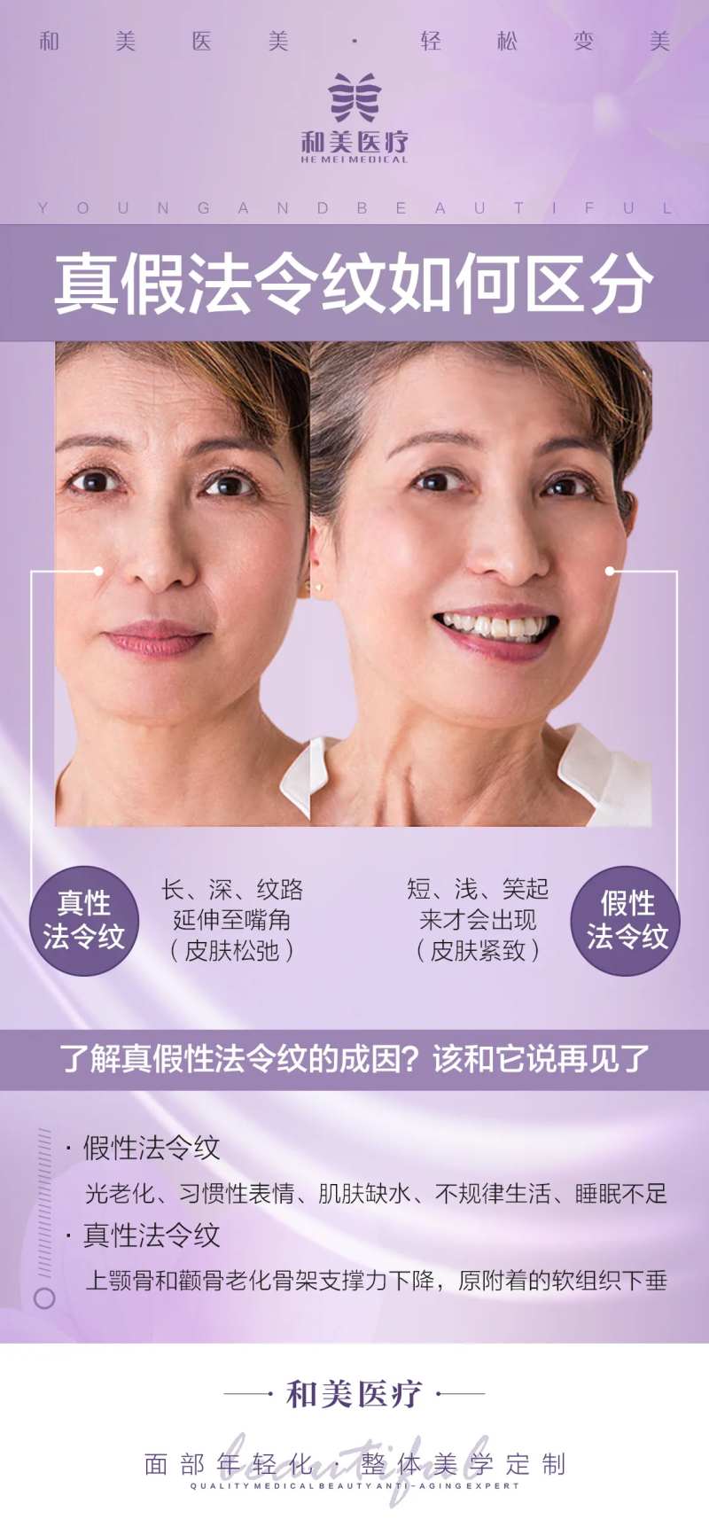 真假法令纹科普-采灵感-cailinggan.com