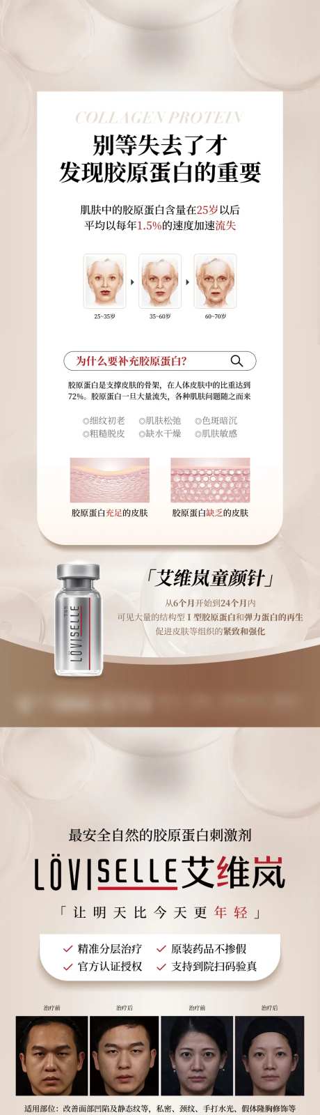 医美艾维岚产品海报-采灵感-https://www.cailinggan.com/