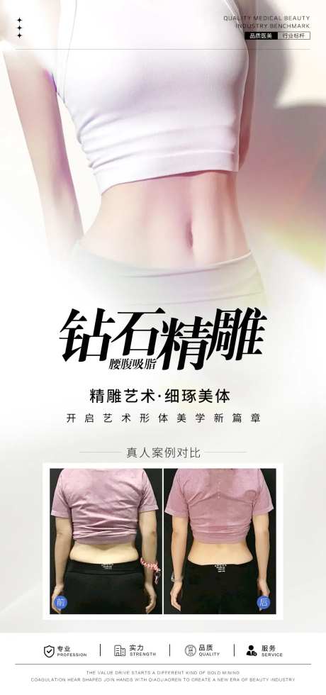 腰腹吸脂案例海报-采灵感-https://www.cailinggan.com/