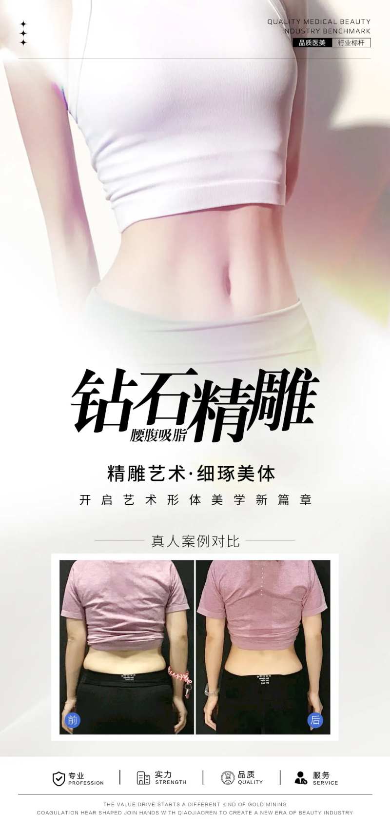 腰腹吸脂案例海报-采灵感-cailinggan.com