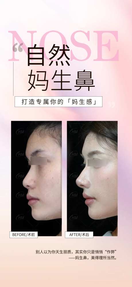 自然妈生鼻案例海报-采灵感-https://www.cailinggan.com/