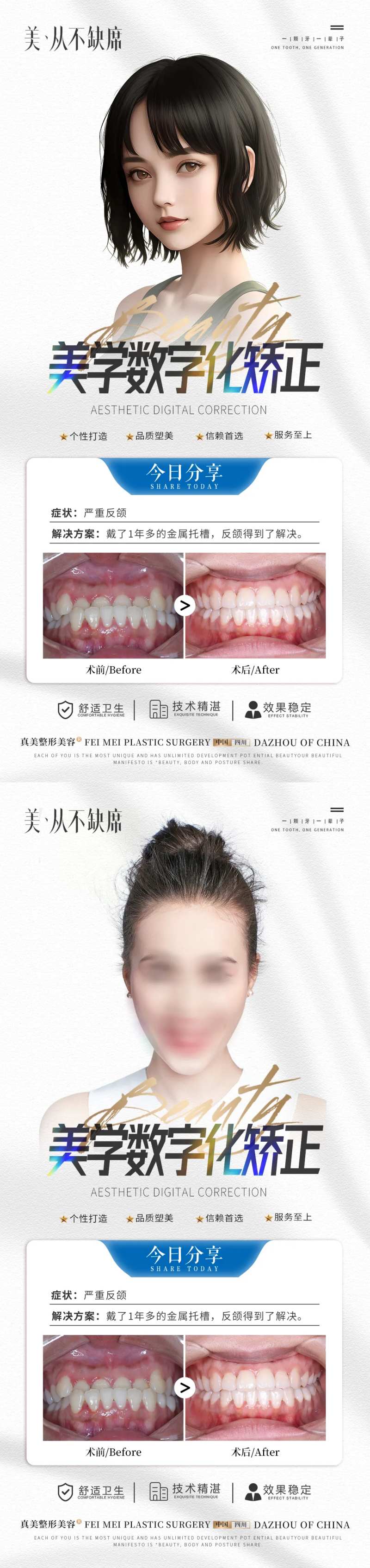 口腔美学数字矫正案例海报-采灵感-cailinggan.com