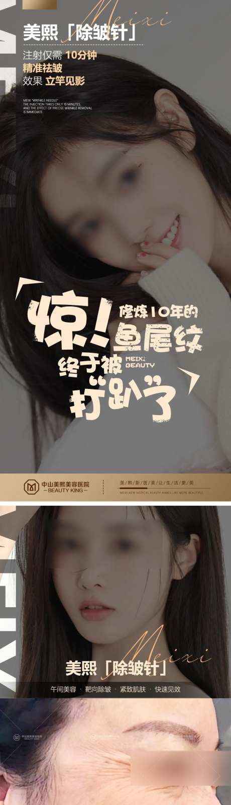 医美除皱针海报-采灵感-https://www.cailinggan.com/