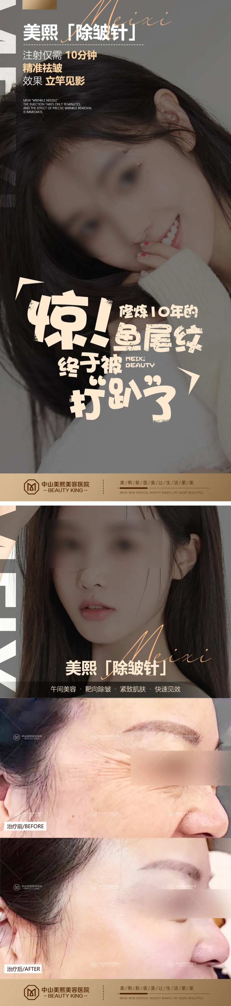 医美除皱针海报-采灵感-cailinggan.com