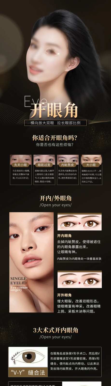 开眼角-采灵感-https://www.cailinggan.com/