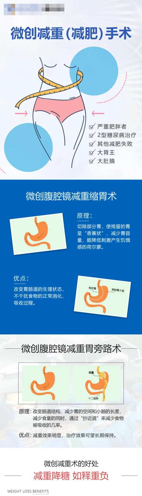 微创减重手术长图专题设计-采灵感-https://www.cailinggan.com/