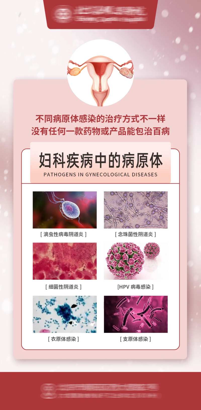 妇科病原体海报 -采灵感-cailinggan.com