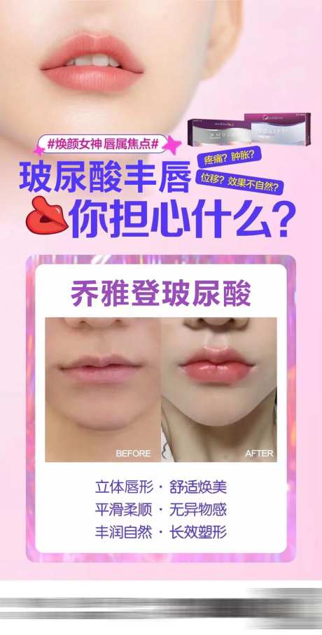 丰唇玻尿酸-采灵感-https://www.cailinggan.com/