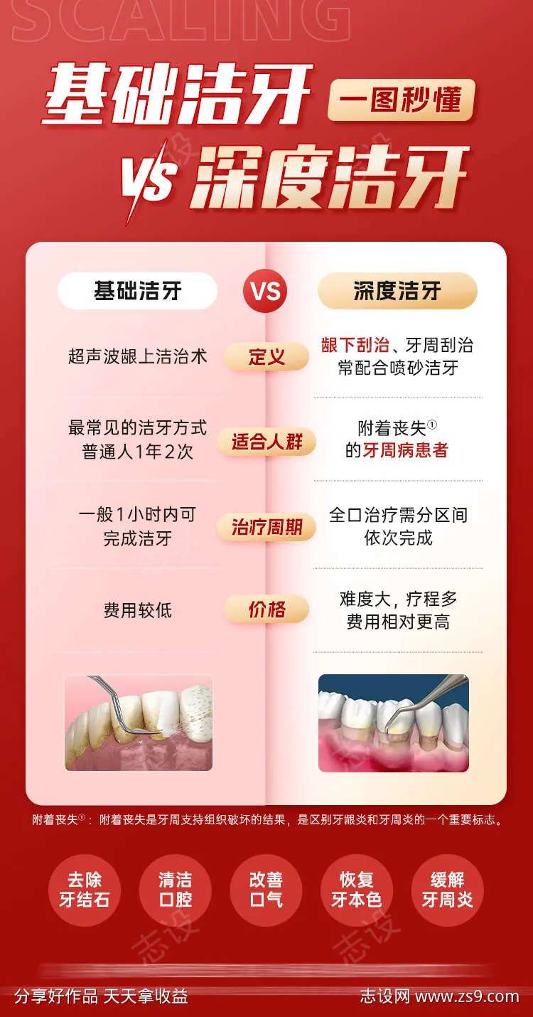 基础洁牙与深度洁牙的区别对比口腔科普-采灵感-cailinggan.com