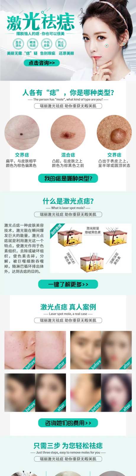 整形医美激光祛痣详情页专题页-采灵感-https://www.cailinggan.com/