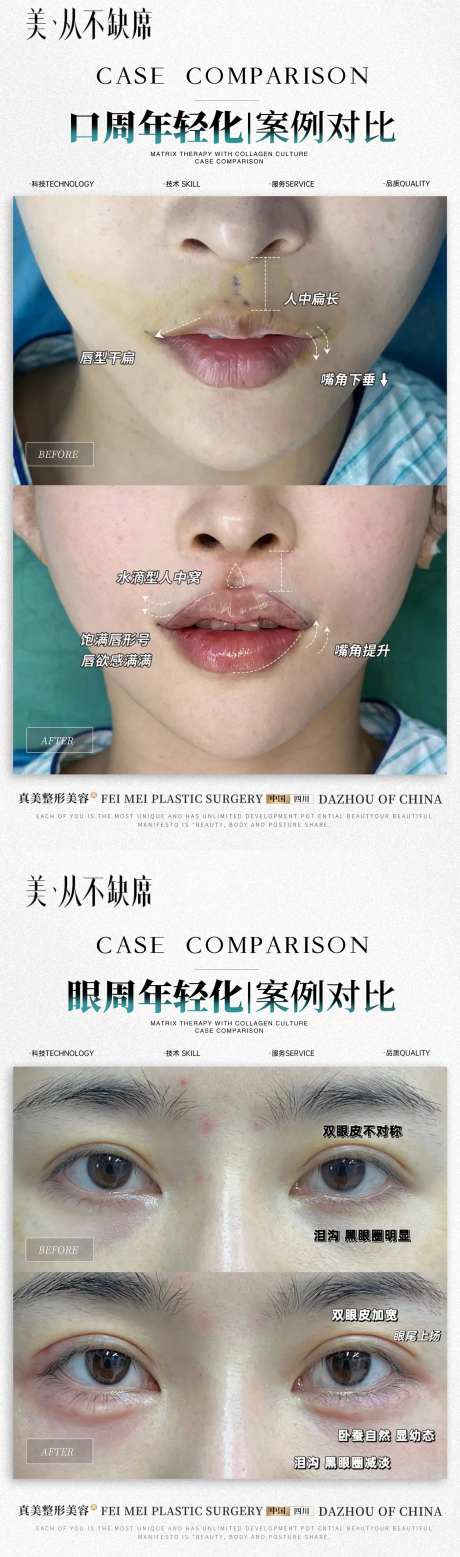 医美口周眼周年轻化案例-采灵感-cailinggan.com
