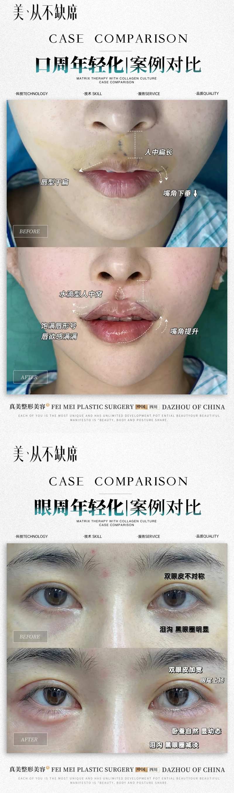 医美口周眼周年轻化案例-采灵感-cailinggan.com