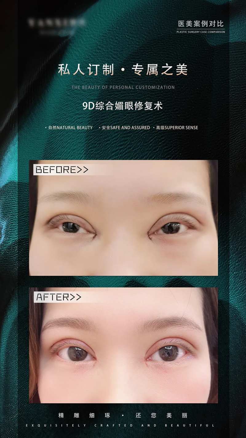 眼综合案例对比蓝金海报-采灵感-cailinggan.com