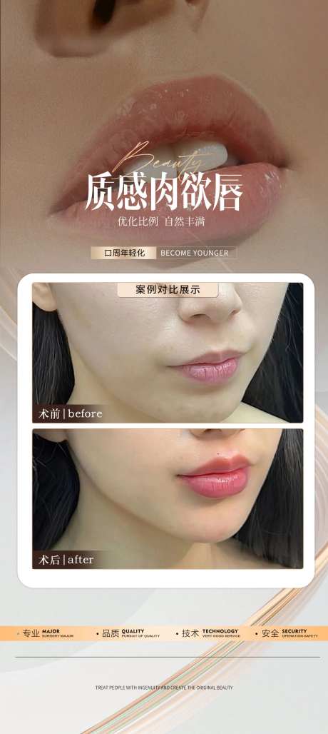 医美嘟嘟唇案例-采灵感-https://www.cailinggan.com/