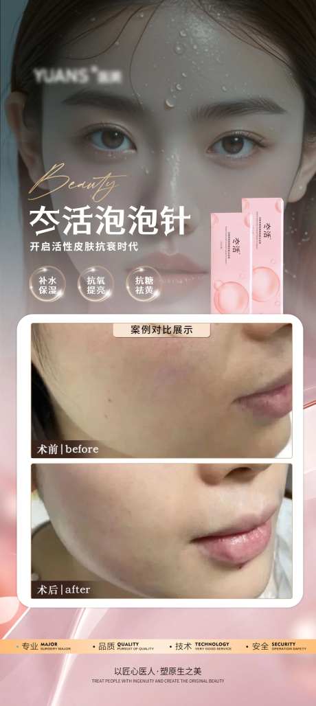医美水光冭活泡泡案例海报-采灵感-https://www.cailinggan.com/