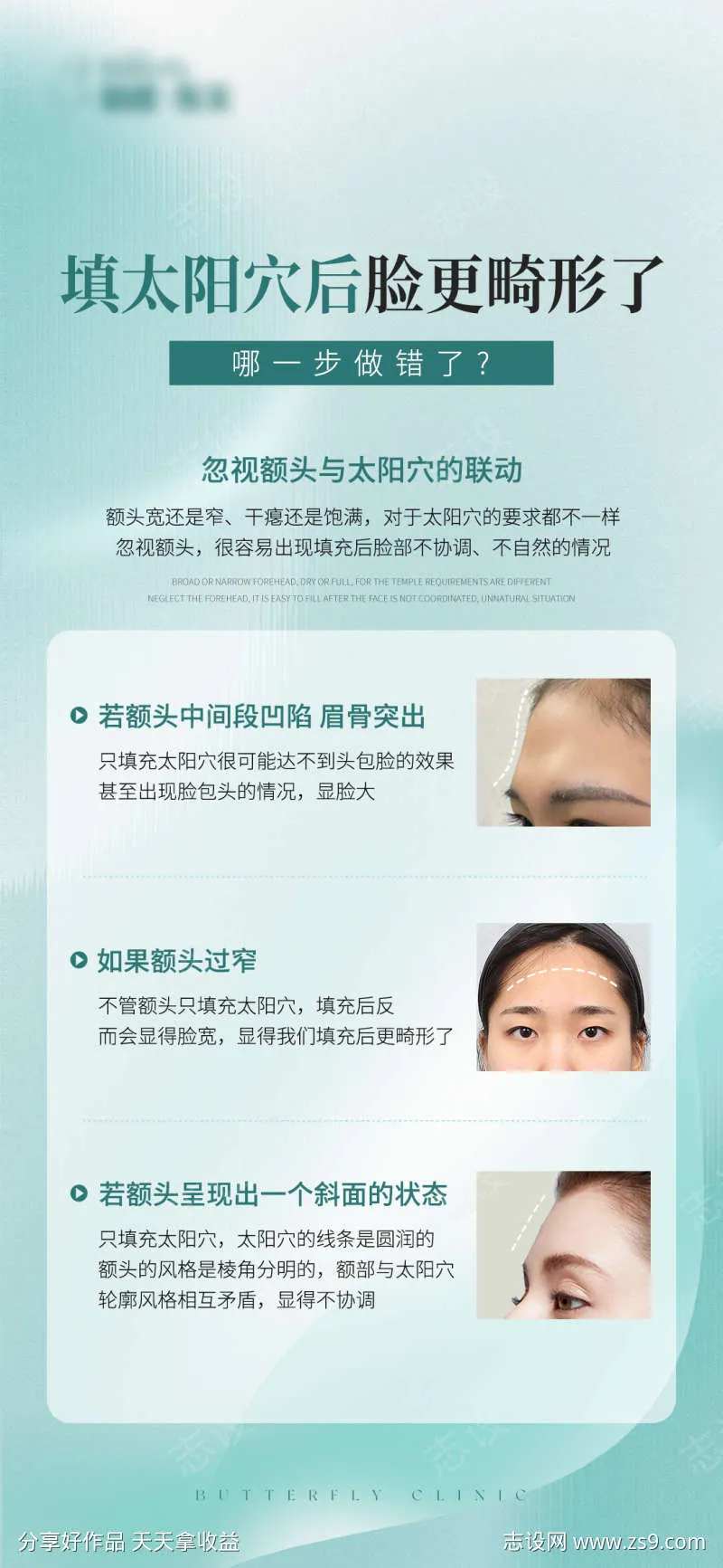 太阳穴凹陷科普海报-采灵感-cailinggan.com