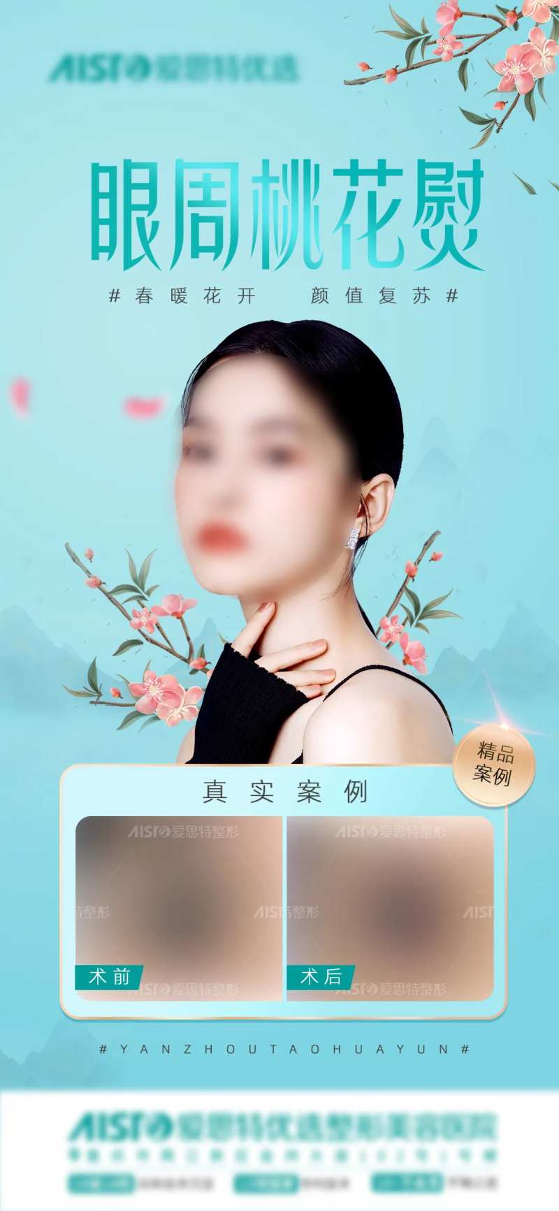 双眼皮眼周桃花熨海报 -采灵感-cailinggan.com