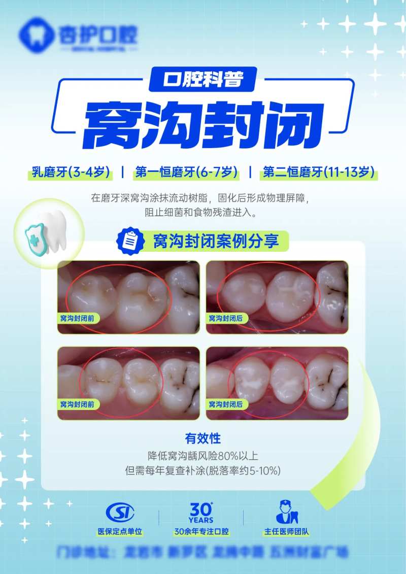 窝沟封闭科普海报-采灵感-cailinggan.com