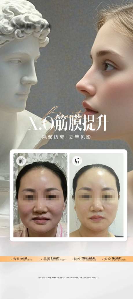 医美外轮廓筋膜提升案例海报-采灵感-https://www.cailinggan.com/