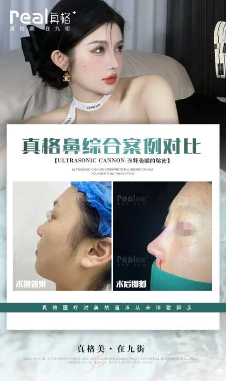 医美案例对比图-采灵感-https://www.cailinggan.com/