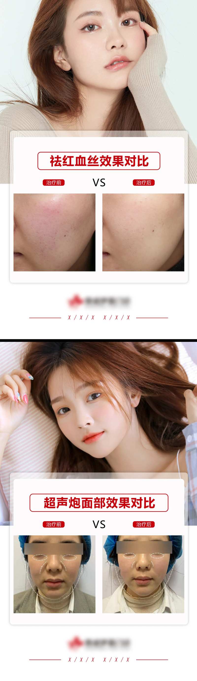 医美案例模板-采灵感-cailinggan.com