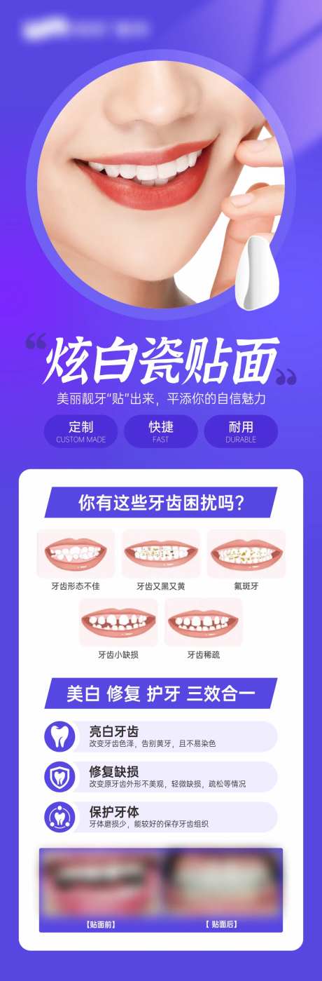 炫白瓷贴面-采灵感-https://www.cailinggan.com/