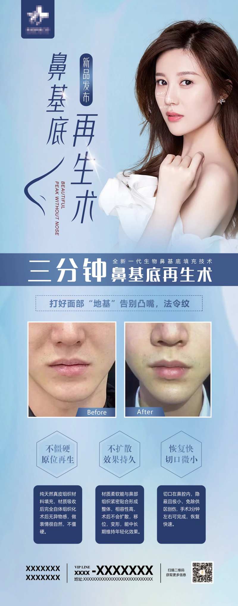 鼻基底再生术-采灵感-cailinggan.com