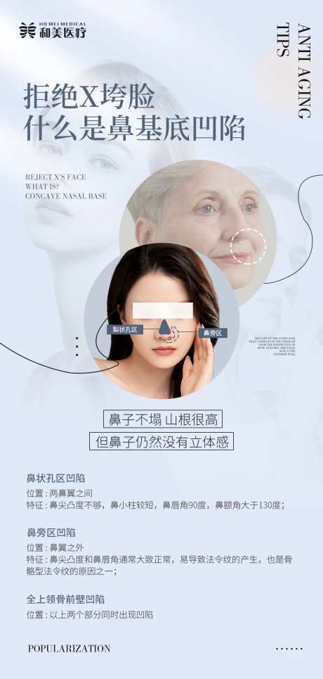 鼻基底凹陷类型科普海报-采灵感-https://www.cailinggan.com/