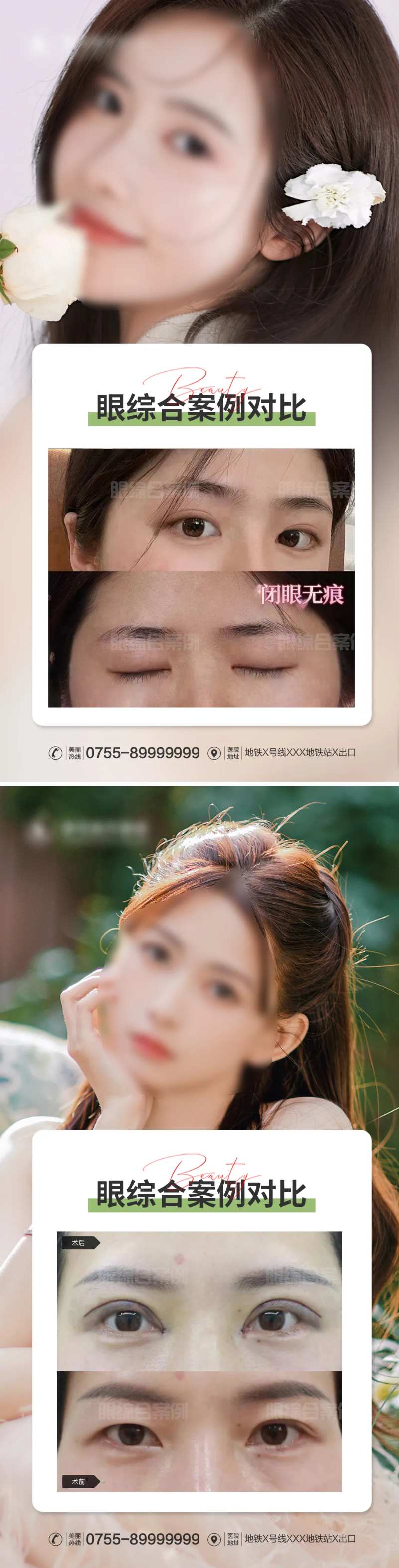 医美眼综合案例对比-采灵感-cailinggan.com