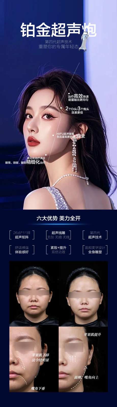 铂金超声炮-采灵感-https://www.cailinggan.com/