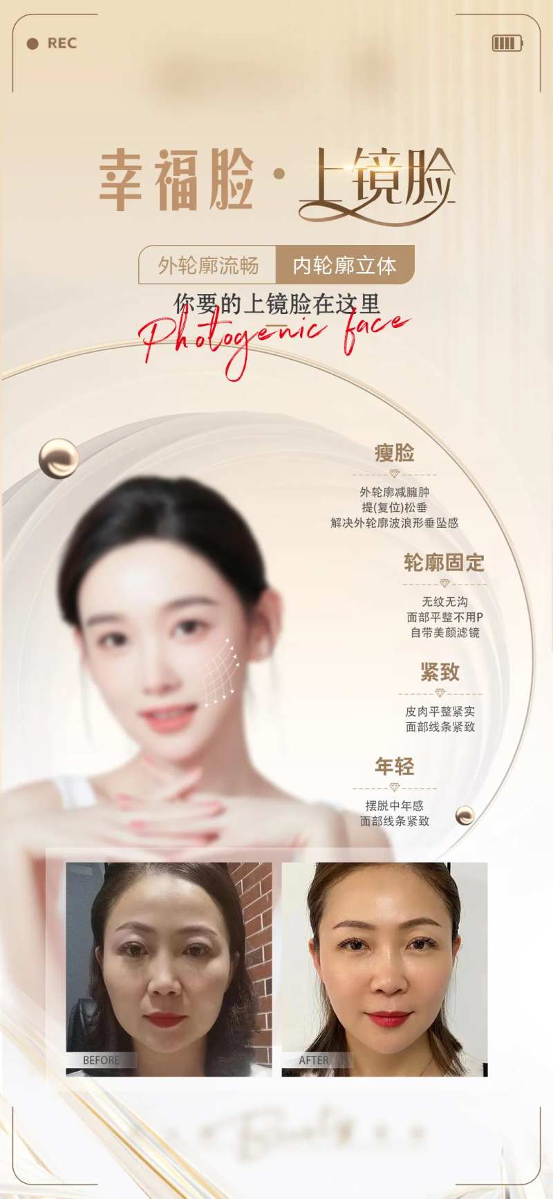 医美上镜脸海报-采灵感-cailinggan.com