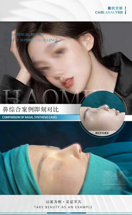 医美案例对比图-采灵感-https://www.cailinggan.com/