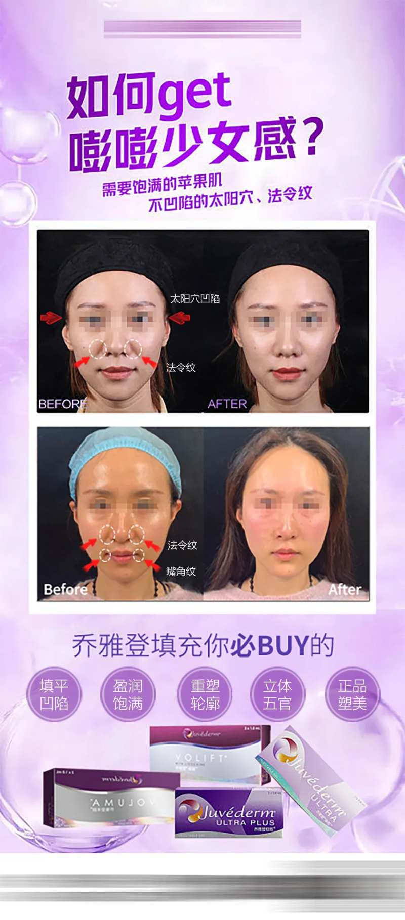 乔雅登面部填充案例海报-采灵感-cailinggan.com