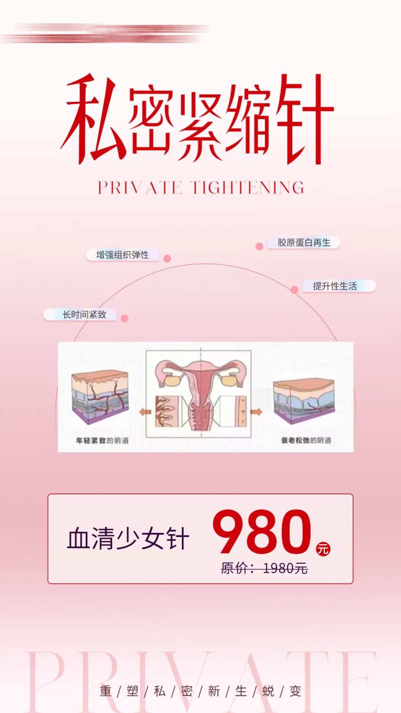 私密紧缩针-采灵感-cailinggan.com