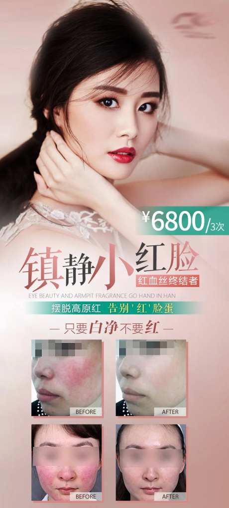 红血丝案例海报-采灵感-https://www.cailinggan.com/