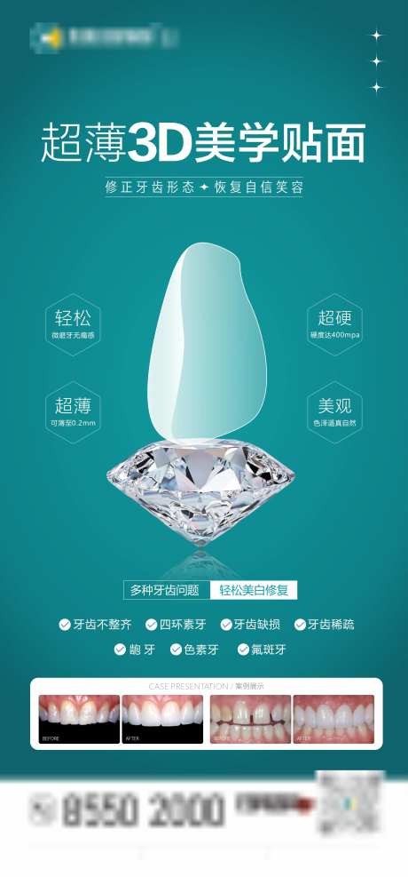 口腔美学贴面海报-采灵感-https://www.cailinggan.com/