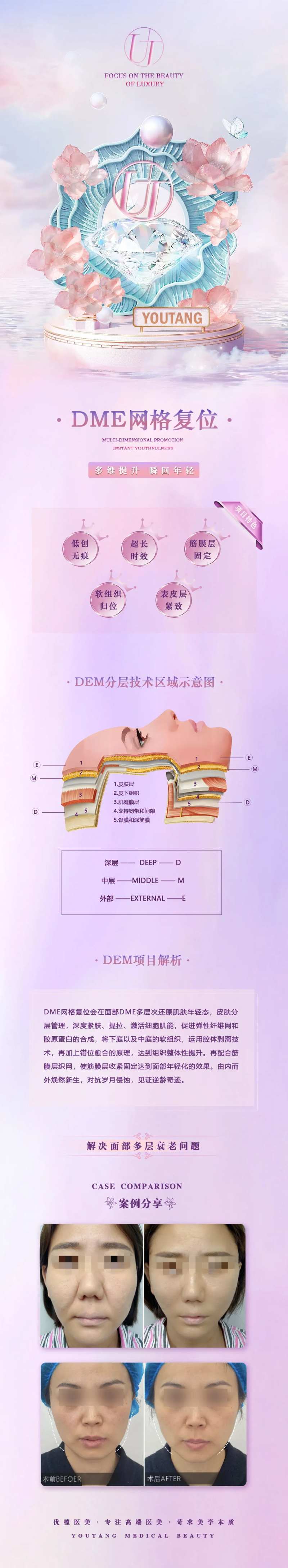 医美网格复位长图-采灵感-cailinggan.com
