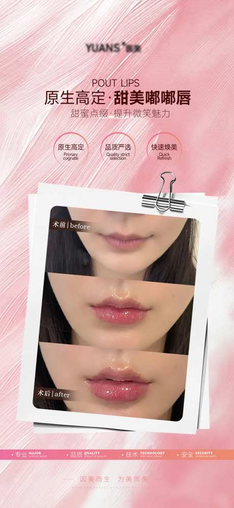 医美嘟嘟唇丰唇案例-采灵感-https://www.cailinggan.com/
