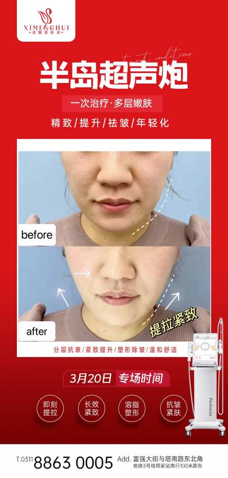 超声炮案例医美整形海报-采灵感-https://www.cailinggan.com/