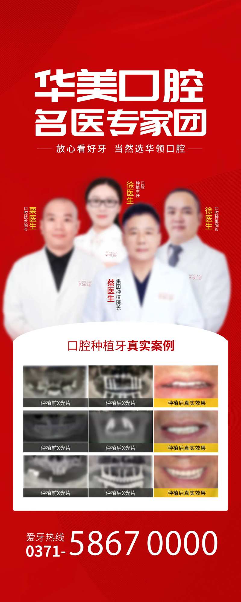 医美义诊宣传专家易拉宝-采灵感-cailinggan.com