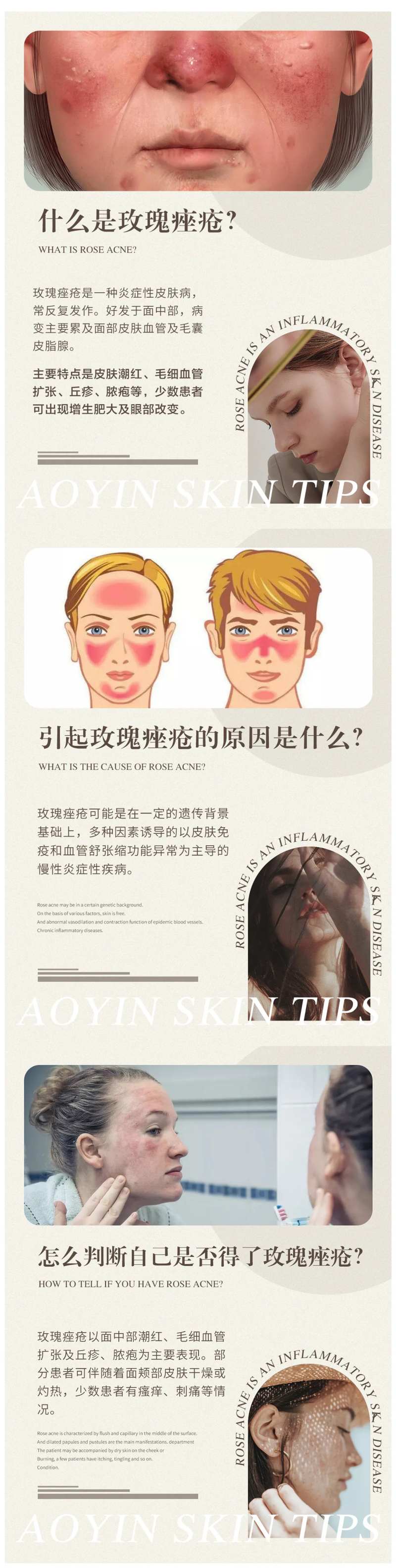 玫瑰痤疮常识干货分享-采灵感-cailinggan.com