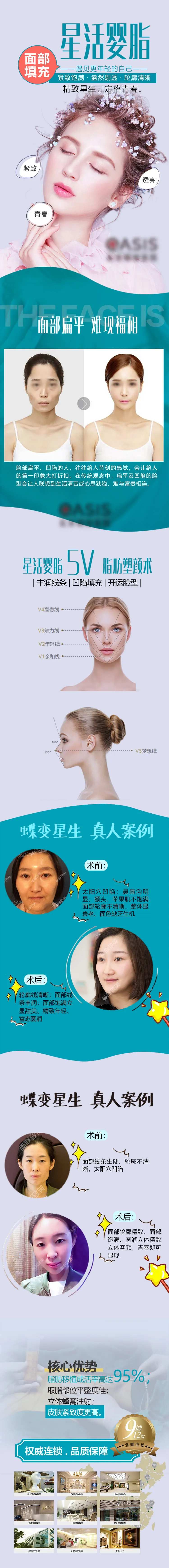 医美线上面部填充详情专题页-采灵感-cailinggan.com