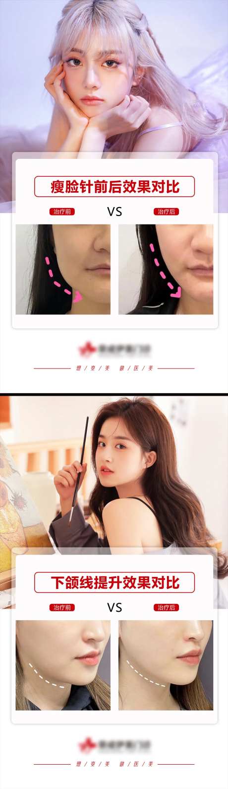 医美案例模板系列海报-采灵感-https://www.cailinggan.com/