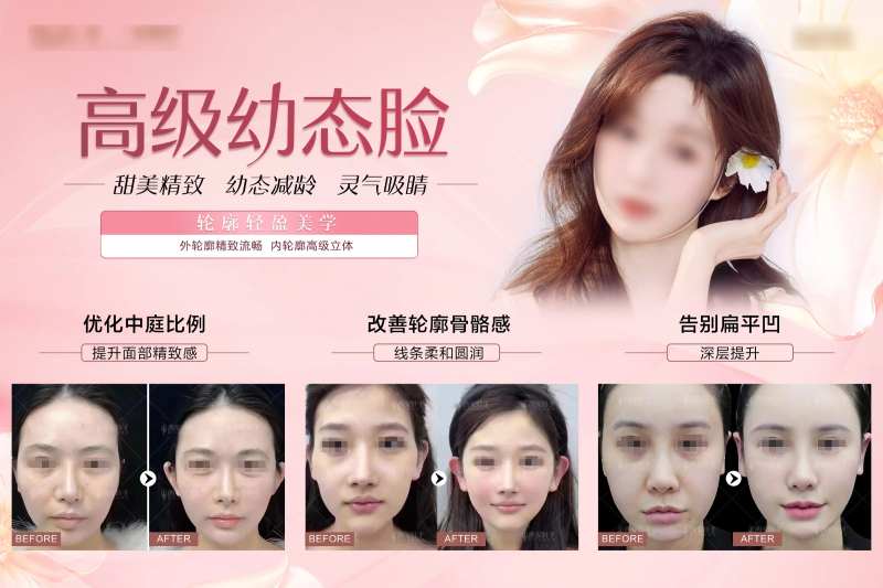 整形幼态脸优惠券                                                                                                                                                                                                -采灵感-cailinggan.com