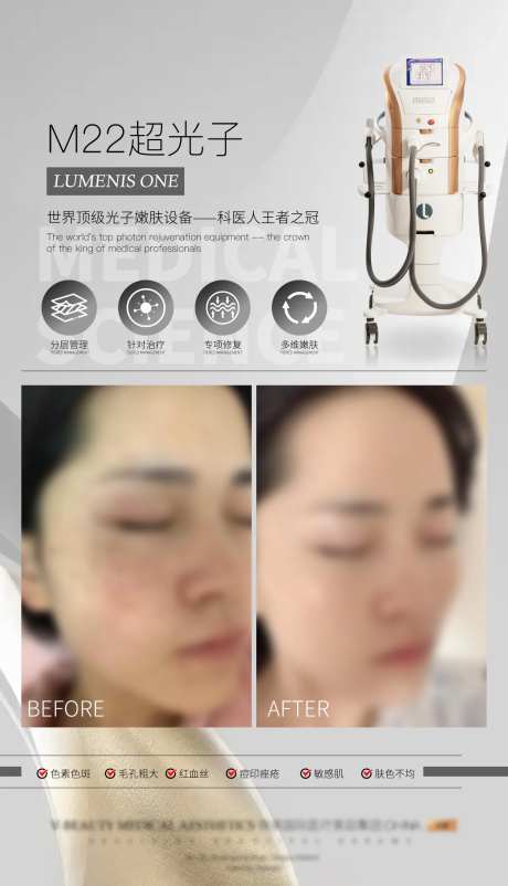 光子嫩肤案例对比海报-采灵感-https://www.cailinggan.com/